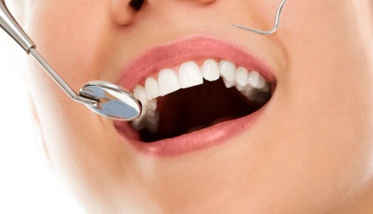 Deal With Loose Teeth