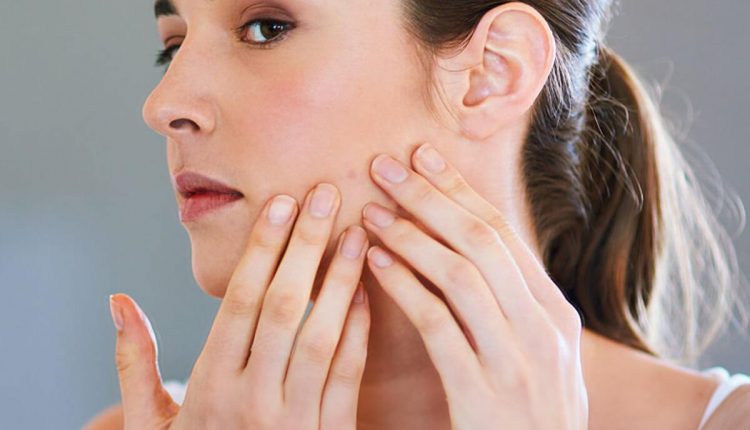 Effective Skincare Products for Acne-Prone Skin