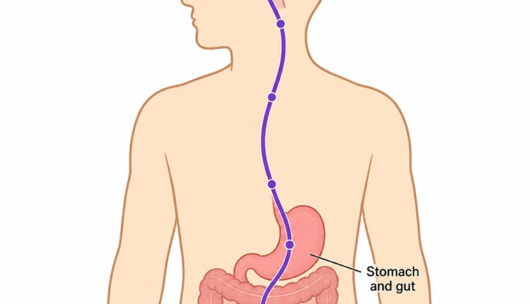 wegovy weight loss injections